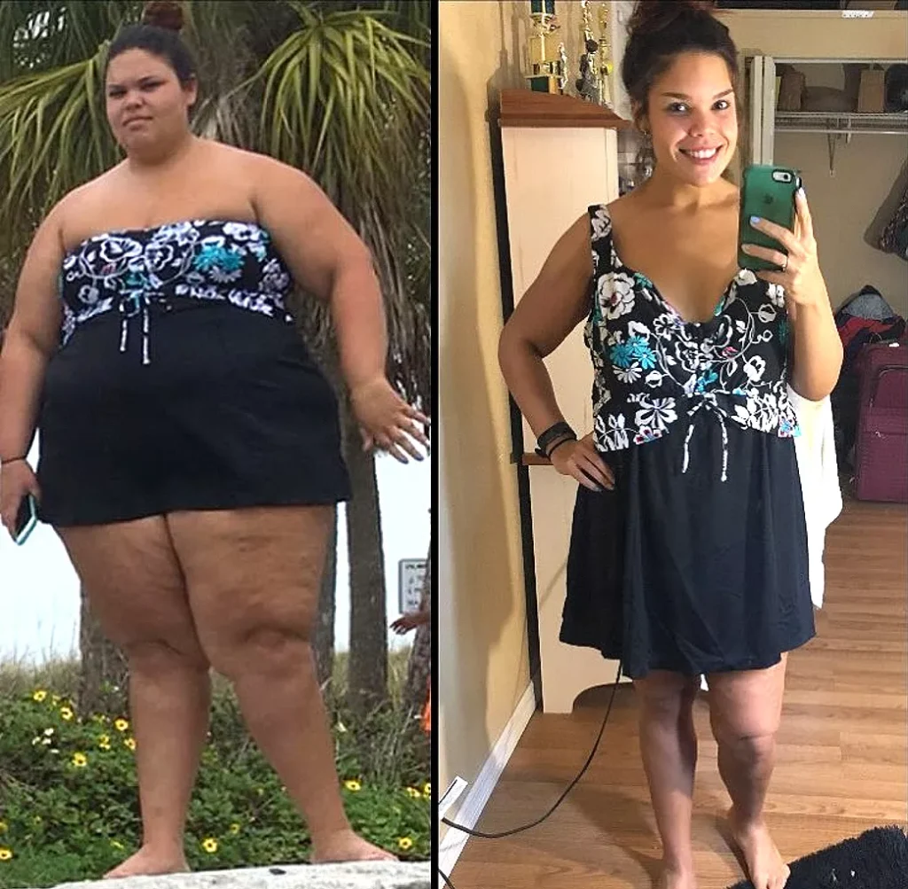 Real body transformation results of a user after using Trimology for weight management.
